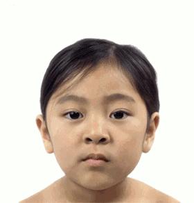 除皱效果最好的方法,全球公认效果最好的除皱方法