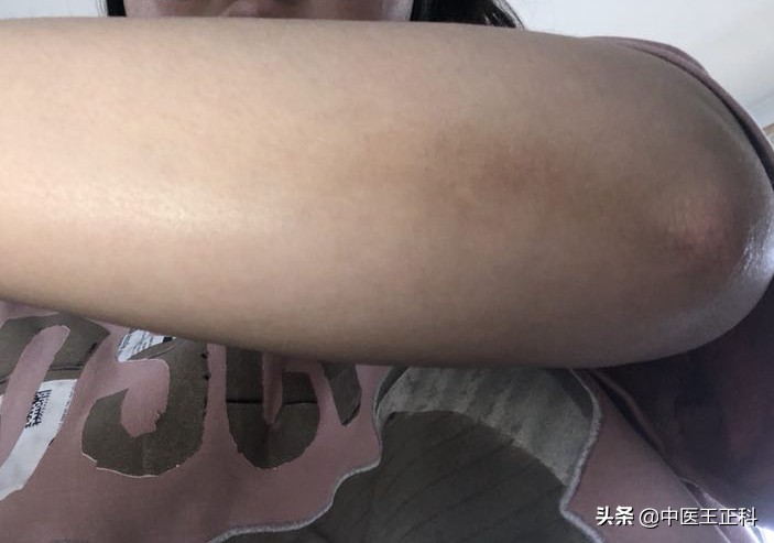 深圳私企女职工怀孕,广东深圳女子怀孕