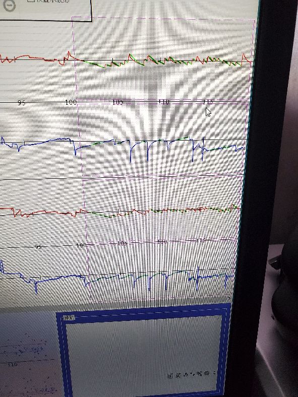 老年人颈椎病引起头晕恶心呕吐,头晕恶心干呕是不是颈椎病