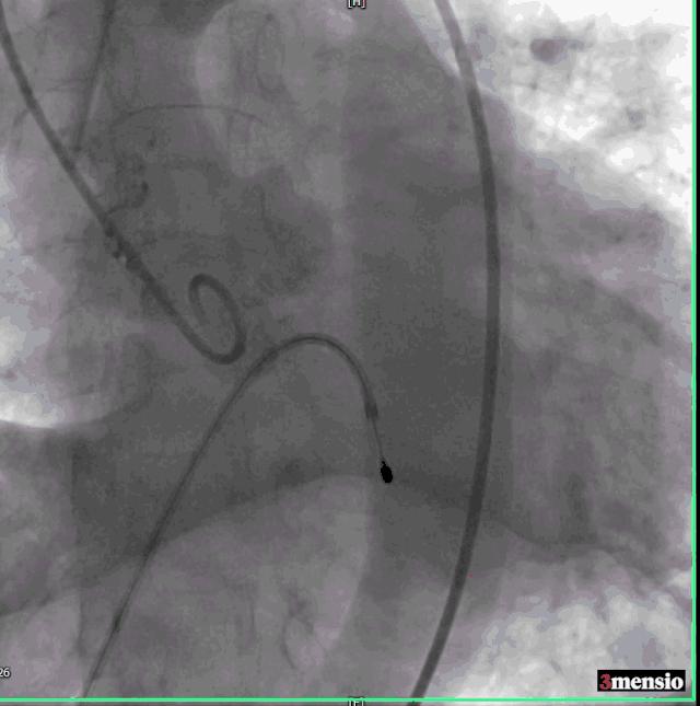 罗建方医生怎么样,罗建方教授