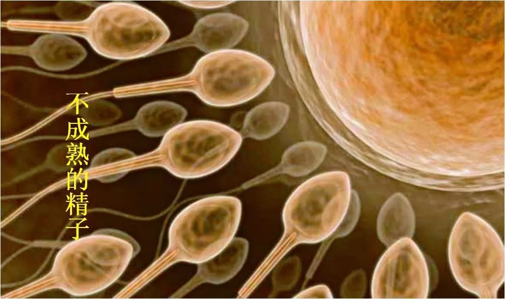 精索静脉曲张引起精子畸形率98%,精索静脉曲张风险多大