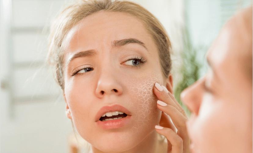 脸蛋特别干燥脱皮是怎么回事,脸干燥脱皮怎么保湿护肤