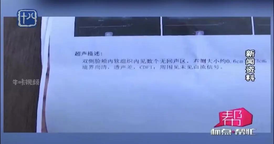 女子花9万元打玻尿酸老了十岁,9万元注射童颜针