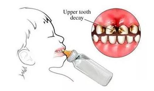 奶瓶和学饮杯怎么选择,宝宝水杯6个月学饮杯推荐测评