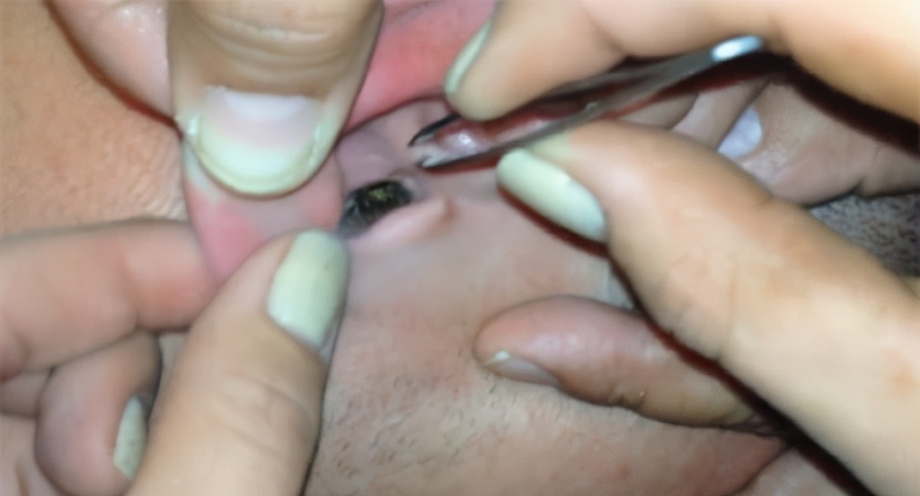 蟑螂为什么喜欢在插座底下下崽,蟑螂为什么喜欢钻入耳朵