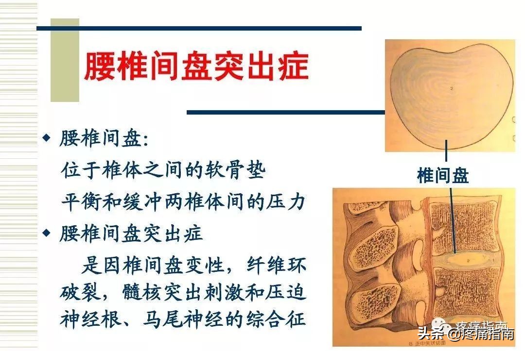 慢性疼痛常用的治疗方法,慢性疼痛常用治疗方法