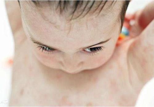 蓓蕾宝宝婴儿洗衣液,蓓蕾宝宝婴儿洗衣液成人可以用吗