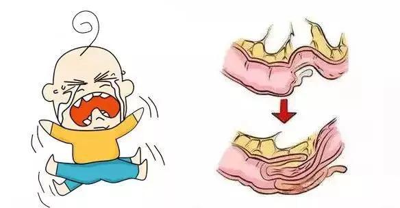 孩子哭闹是消化不良吗,孩子哭闹一定是不舒服吗
