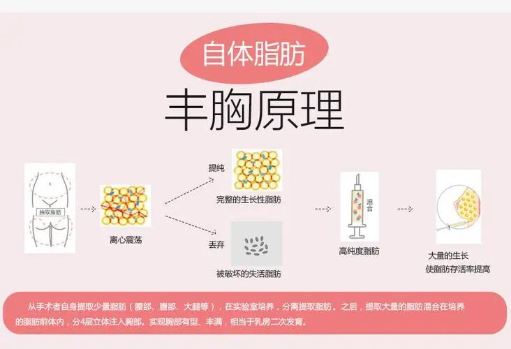 假体隆胸5大流言正解,假体隆胸科普