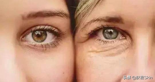 有什么沟必须火的,泪沟后面有一条很深的沟叫什么