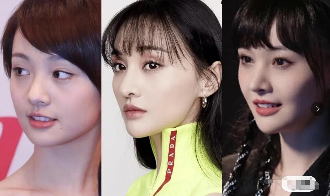 盘点一些有问题的鼻子,明星都没整好的鼻子