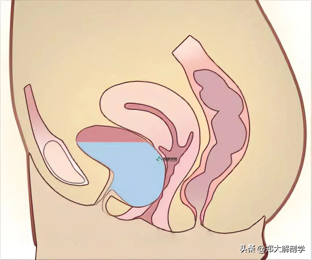 女性盆底功能障碍性疾病表现,盆底功能障碍会引起失眠吗