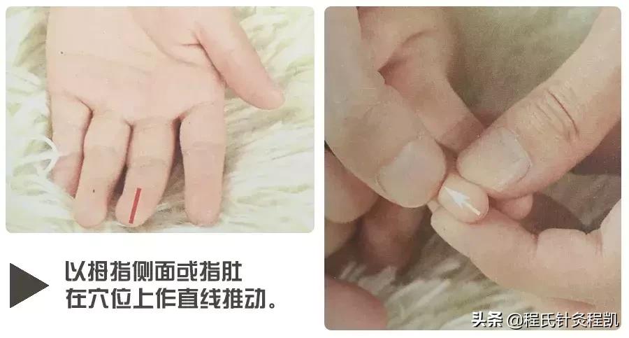 湿疹推拿要清脾还是补脾,小儿湿疹的推拿方法