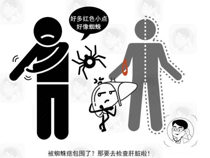 早期体内有癌怎么查才知道,身体里有癌手脚先告诉你什么症状