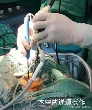 对骨科微创技术的认识,骨科手术与保守治疗对比