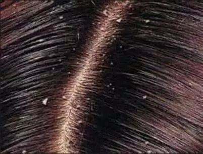 出道13年老剃头匠教你如何应对秋冬季头发爱出油头发干燥问题