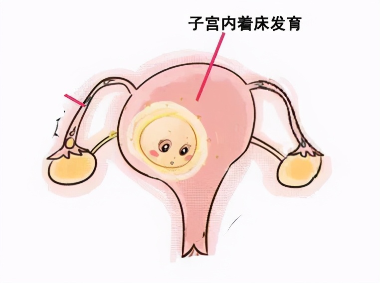 孕期出血肚子不疼正常吗,孕期出血怎么判断是不是流产