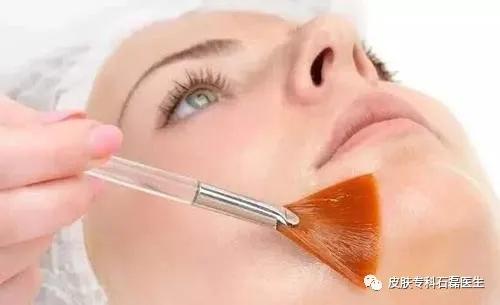 祛褐斑的最佳方法,去除褐斑的最好治疗方法