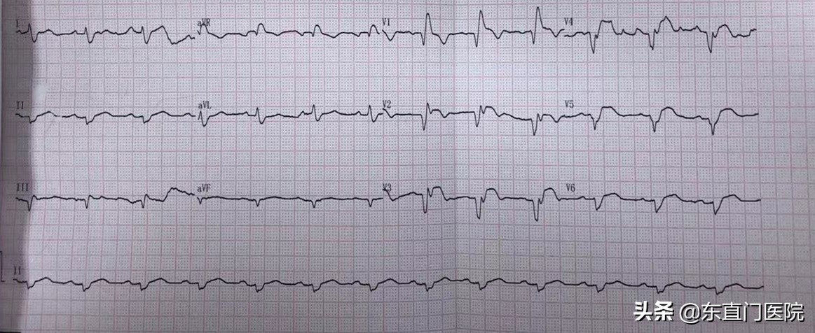 精确规范力挽狂澜