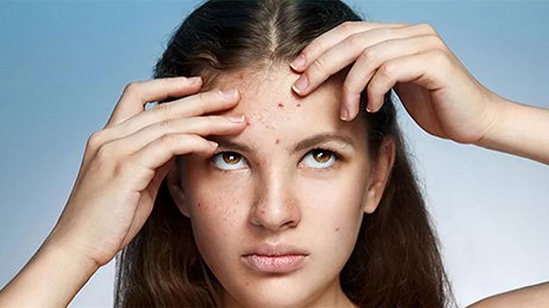 耶鲁公共卫生研究团队,耶鲁科学家发现hpv病毒