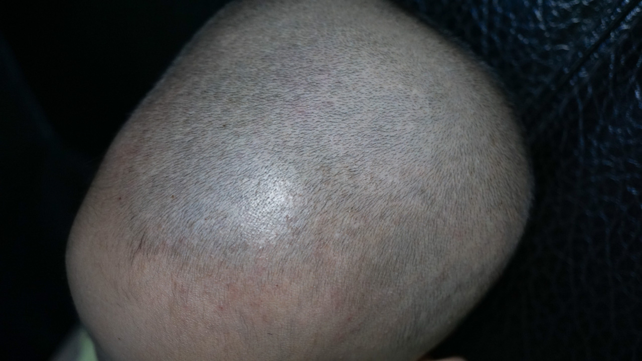 易简婴儿理发器缺点,易简婴儿理发器第五代