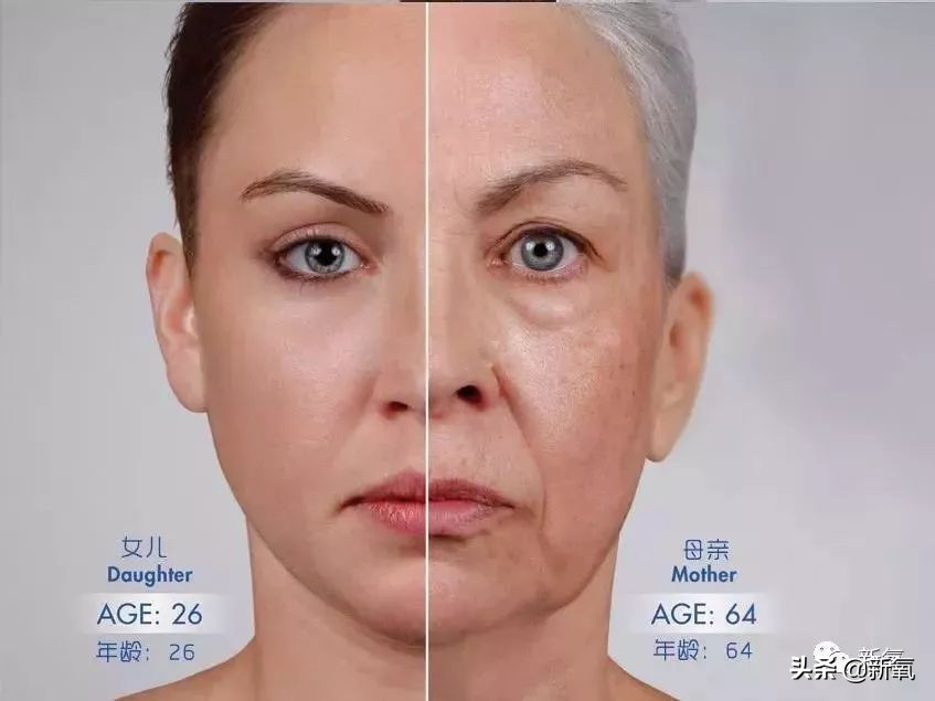 景甜修复后的双眼皮多宽,景甜修复之后的双眼皮是多宽