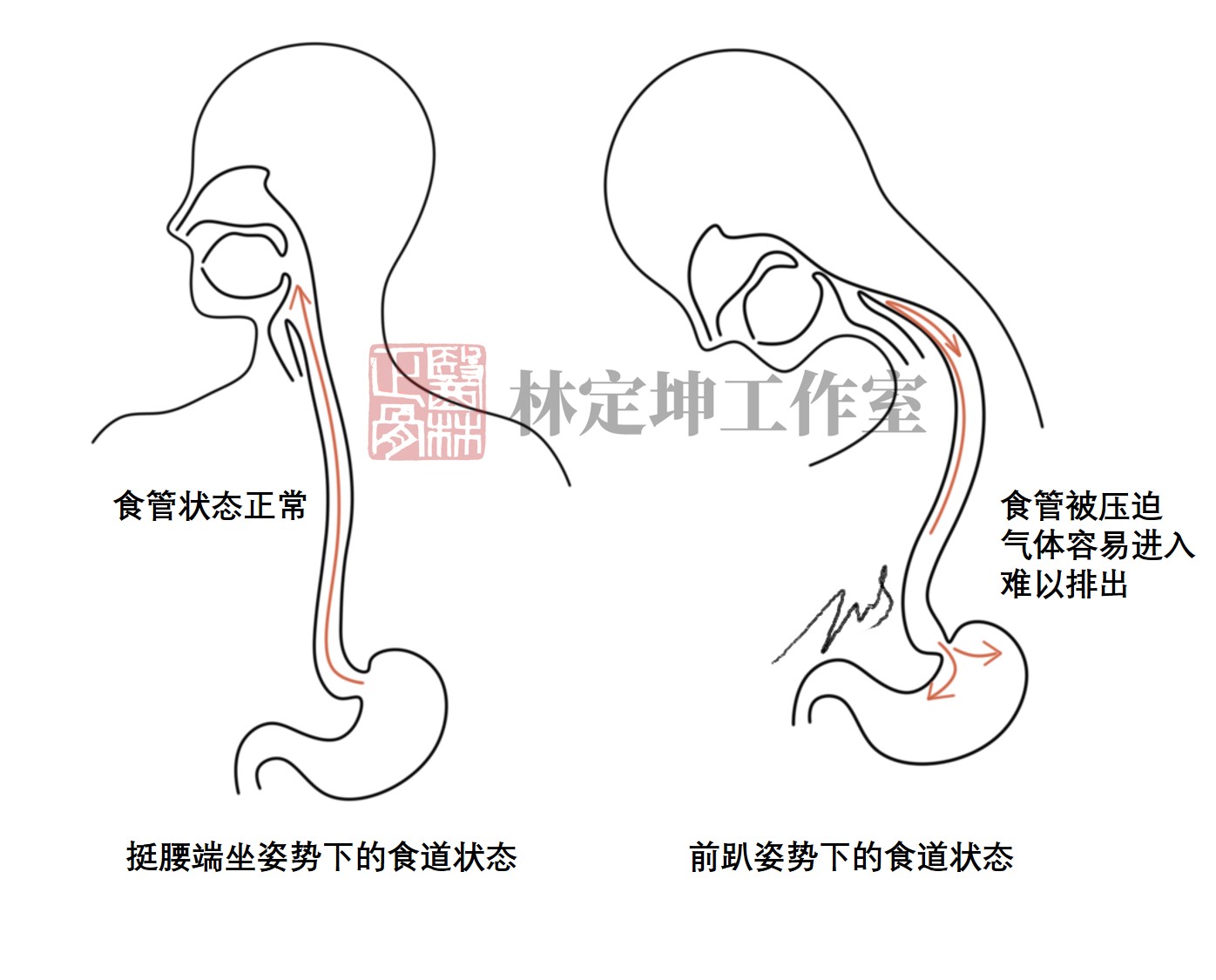 医林正骨丨不睡怕犯困，一睡颈椎疼，午休的正确姿势到底是什么？
