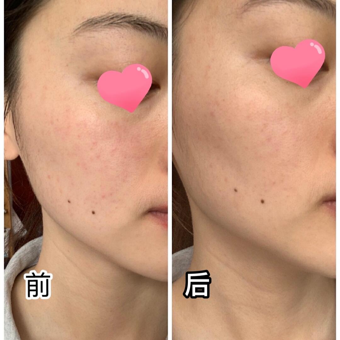 jm面膜燕窝精华好用吗,鱼子酱面膜和燕窝面膜哪种好用些