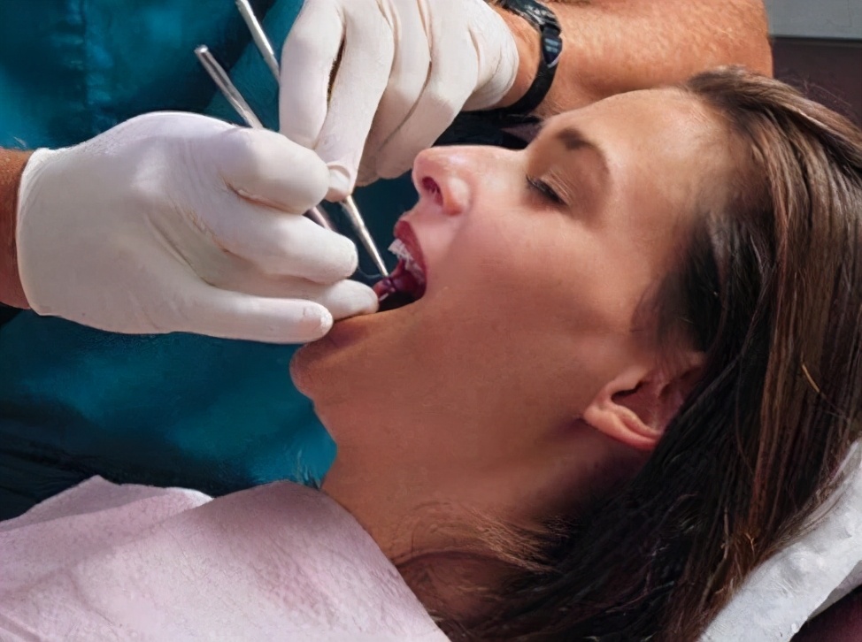 拔牙过后一直麻是对的吗,拔牙之后一直疼