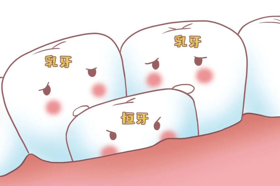 姚晨自曝儿子换牙问题，很多孩子中招！牙齿健康，家长们都要注意