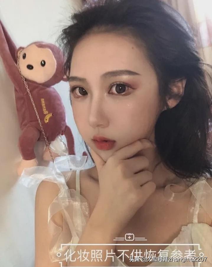 颧骨颧弓内推手术全过程真人,颧骨内推颧弓手术恢复全过程分享