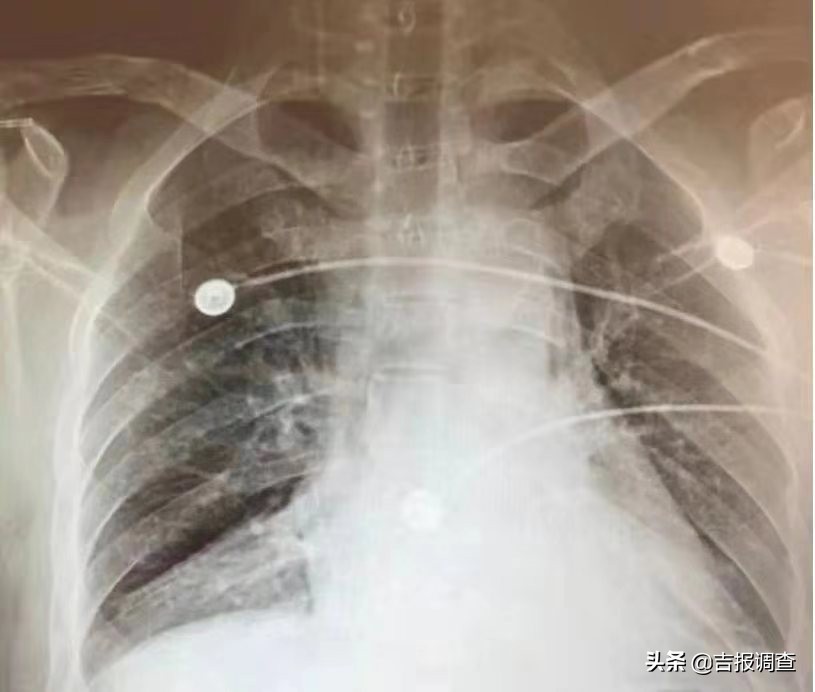 吉林国文医院介入科,吉林省国文医院