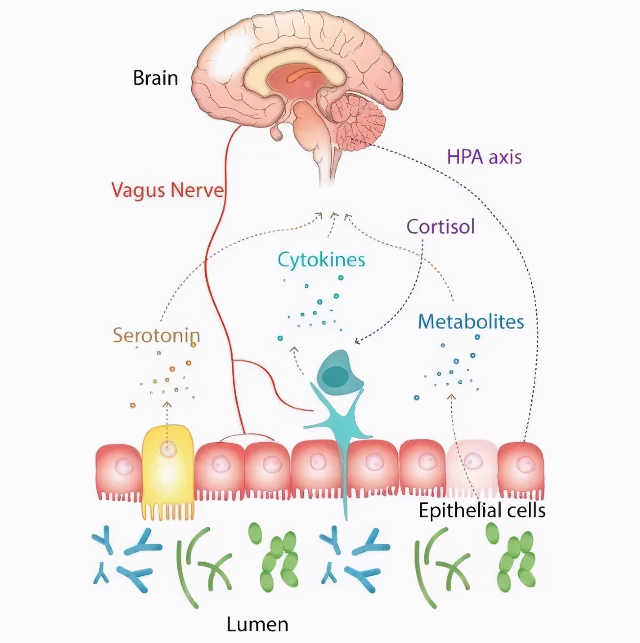 肠道菌群移植治疗抑郁症,抑郁症发病在肠道怎么调整菌群