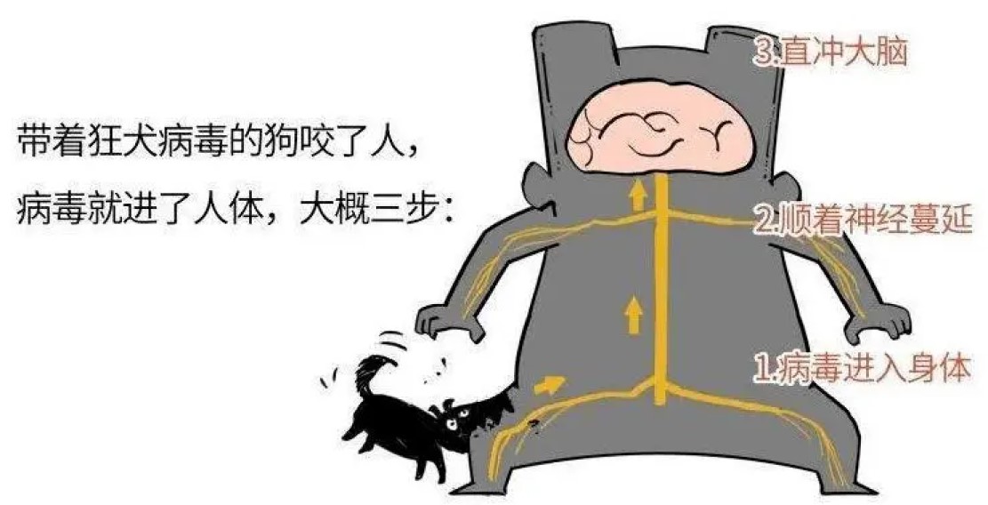 被狗咬有疯狗病吗,被疯狗咬后真的会像狗一样叫吗