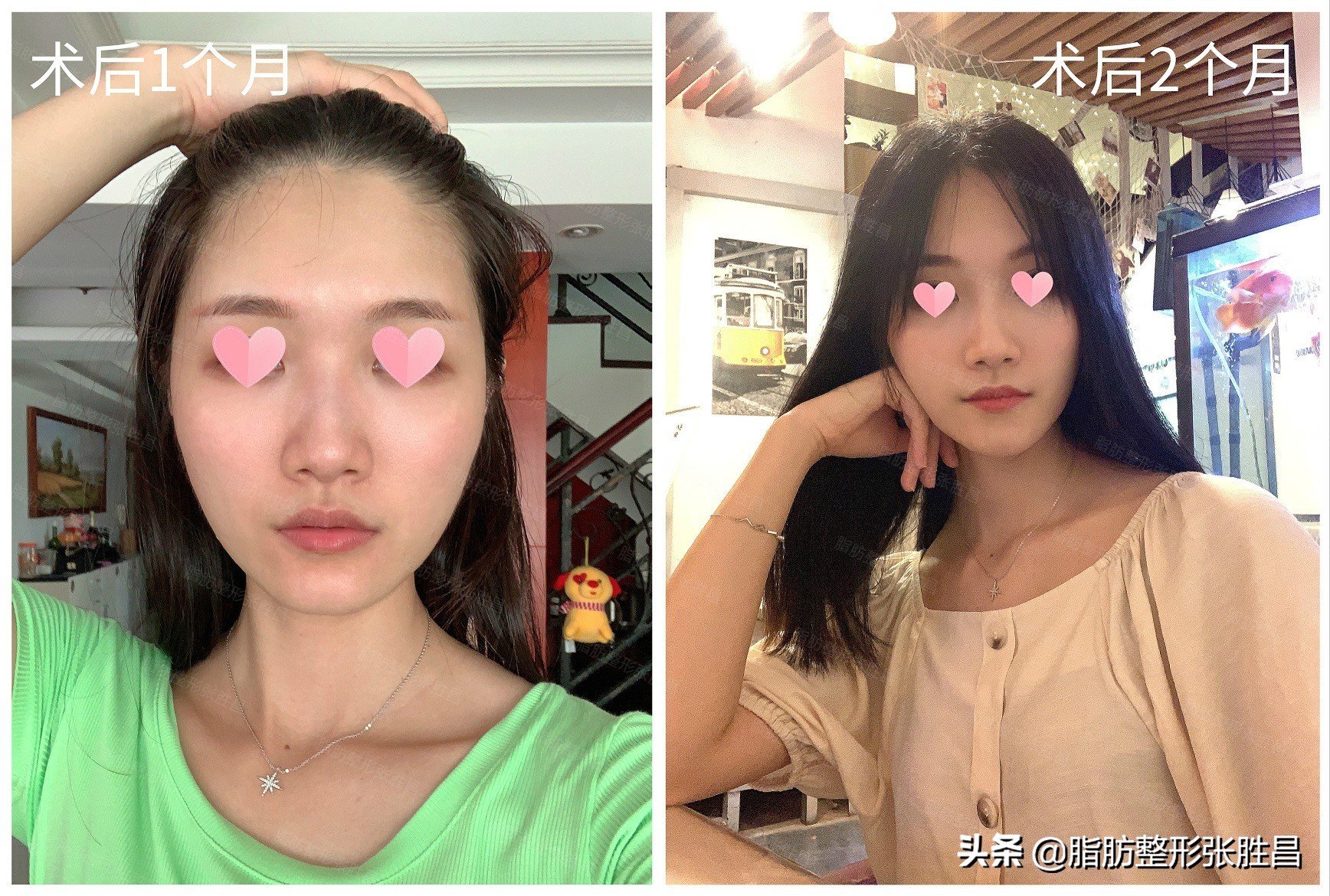 面部特别凹陷的人命运,面部凹陷超显老