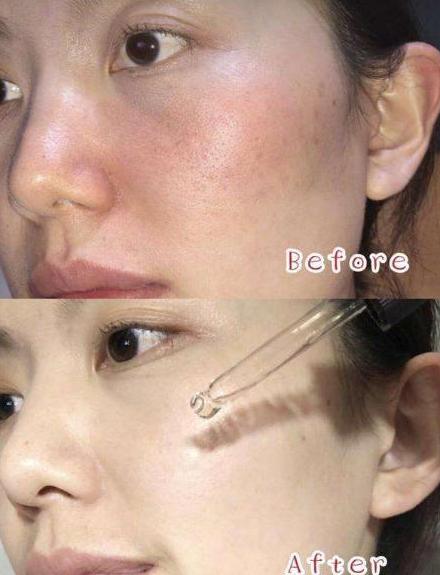 烟酰胺原液美白效果好,美白精华搭配烟酰胺原液