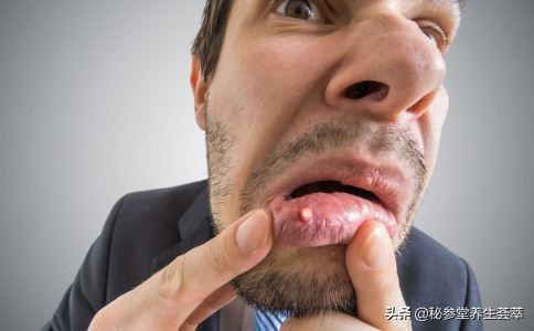 口腔溃疡有什么症状及治疗方法,口腔溃疡是怎么引起的最快解决法