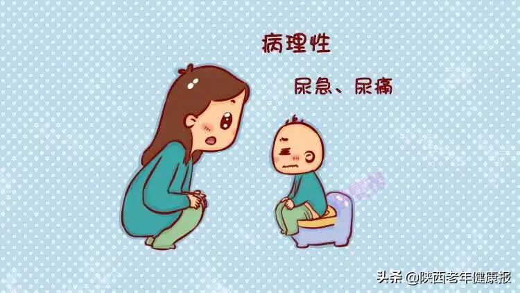 小儿尿急尿频如何治疗最好,小儿健康指导