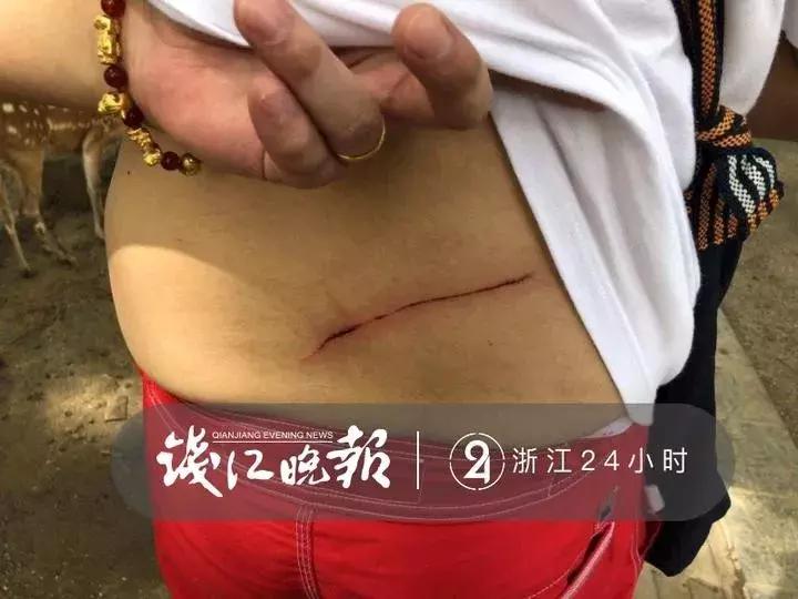 奈良鹿误食塑料袋接连死亡,奈良喂小鹿被撞