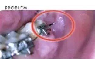 非常时期措施,非常时期保护自己