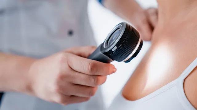 脸上长了很多小肉揪是什么东西,脸上长个小肉刺可以揪了吗