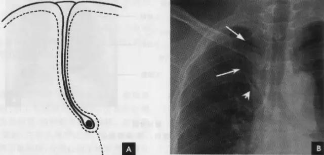 详细的胸部X线解剖，最基础最实用！
