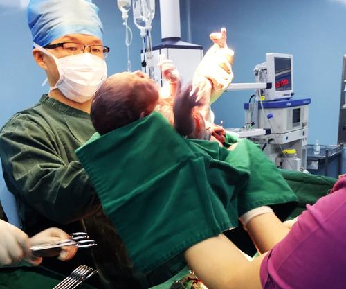 产妇生产的时候放屁的多吗,产妇生产的时候放屁吗