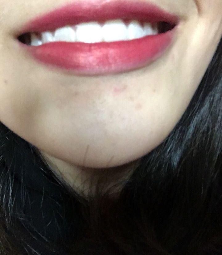 如何改善肤质拥有好皮肤,想要改善皮肤状态吃什么