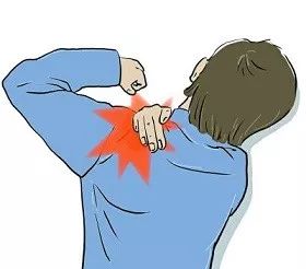 你真的了解肩周炎吗,肩周炎常见的8大误区