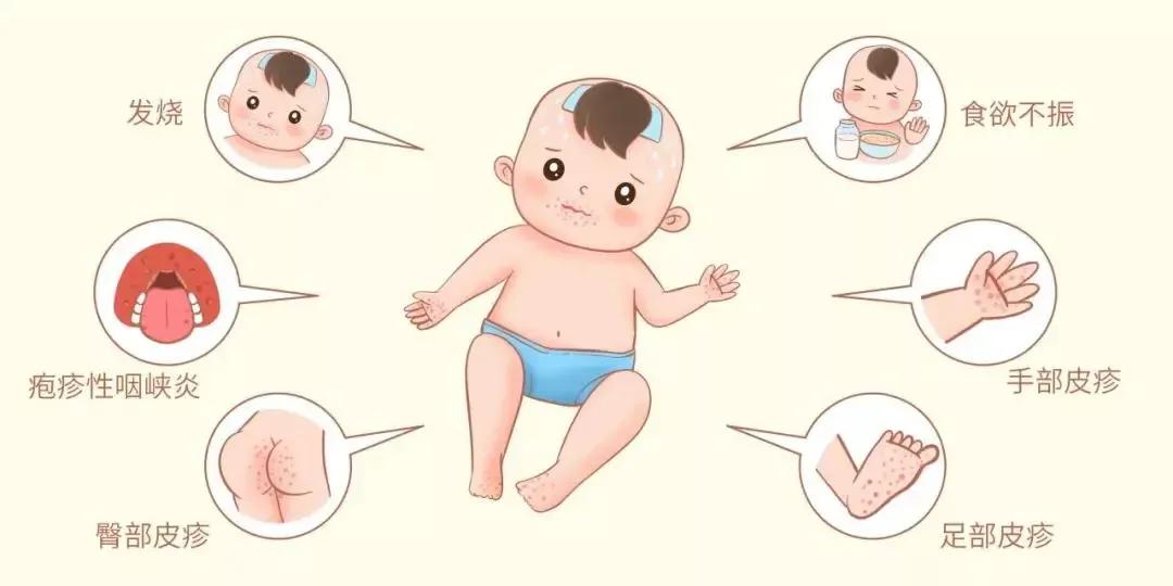 接触出水痘的孩子要再打疫苗吗,我家宝宝打疫苗后发烧