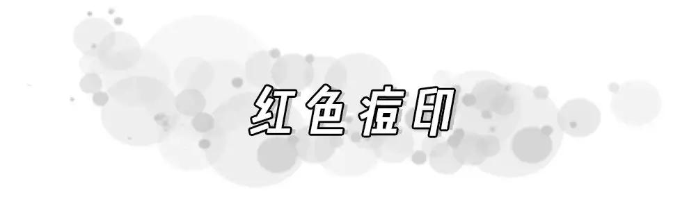 痘印反复冒痘怎么消除男生,痘印痘痘反反复复怎么办