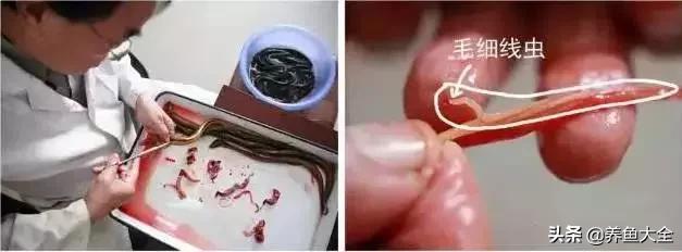 寄生虫多达6000条这种东西别乱吃,寄生虫的典型症状和表现