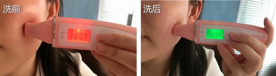 皮肤科医生都推荐的硫磺液体香皂，李佳琦5分钟卖了14406套