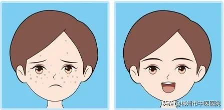 皮秒祛斑后的注意事项,皮秒祛斑后用什么修复